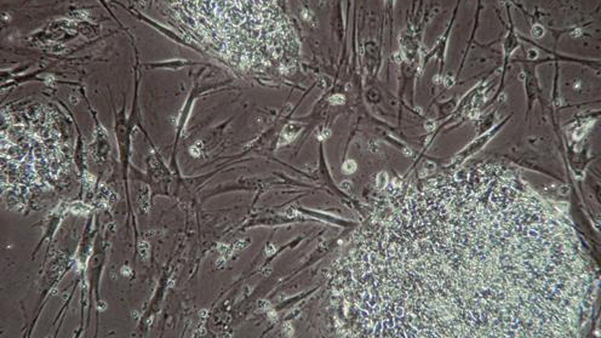 Genetics of personality associated with major life outcomes, study finds