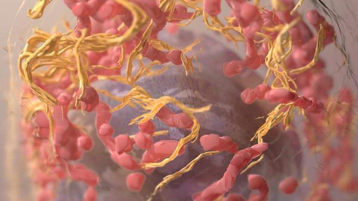 Melanoma in India: why the messaging needs to change to catch it early